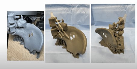 3d-printen-chirurgie-3